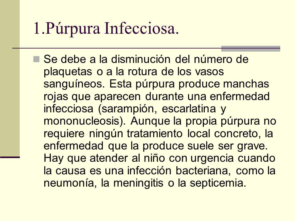 sintomas de la enfermedad purpura fulminante